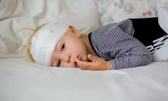 Toddler with a bandaged head resting on a bed after a dog bite injury